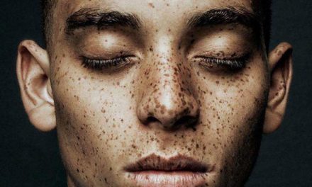 How To Get Freckles Naturally Without Sun