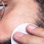 Skin Care Guide for Men – How to Treat Acne Scars With the Right Ingredients