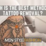 Which Is the Best Method for Tattoo Removal?