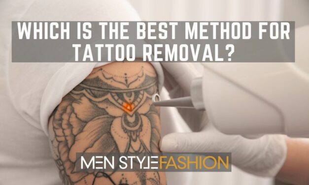 Which Is the Best Method for Tattoo Removal?